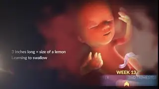 What a Baby Looks Like During the Second Trimester | WebMD