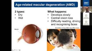 Eye Health for Seniors Webinar