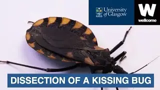 Dissection of a Kissing Bug and Chagas Disease (shorter edit)