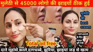 सर्दियों में Pigmenatiton, झाइयों को ठीक करने की best cream/ यह cream नहीं  गोरा बनाने की दवा है