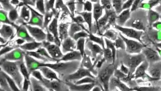 A chemical &lsquo;breadcrumb trail&rsquo; helps melanoma spread | Cancer Research UK