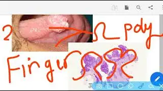 Practical 5:Benign Tumors (General Pathology for Dentistry students)/2'nd semseter final revision