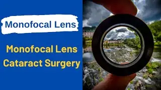 Monofocal Lens | Monofocal Lens Cataract Surgery | Cataract Surgery With A Monofocal Lens