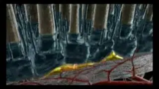 Photodynamic Therapy for Age-related Macular Degeneration