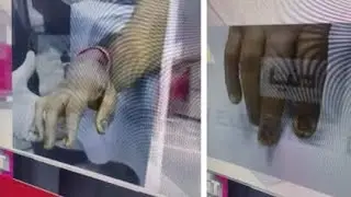 Leaked Disturbing Post Mortem Photographs Of Arshad Sharif Proving He Was Tortured Before Execution