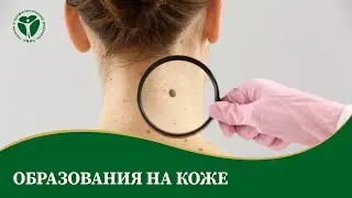 Образования на коже