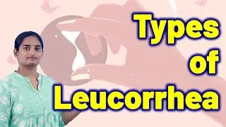 Types of Leucorrhea? | White Vaginal Discharge Periods Problems | Homeopathy Treatment Medicine Cure