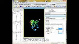EAM Plugin for GIMIAS
