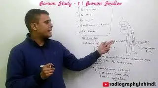 BARIUM SWALLOW or ESOPHAGRAM #radiographyinhindi #xrayclasses