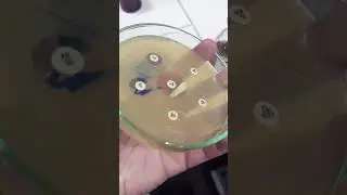 Urine Culture Sensitivity test