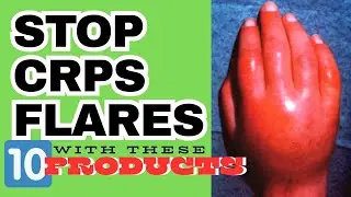 10 EFFECTIVE CRPS RELIEF PRODUCTS! #ithurtscommunity #ithurts #amazonfinds #usa