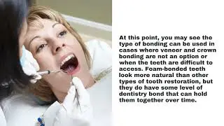Dentist Round Rock, TX - Dental Bonding   How It Works and Why It s Important