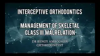 Management of skeletal class III Malrelation  @ Dr Benoy Ambooken (Orthodontist)