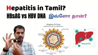 HBsAg in Tamil | HBV DNA in Tamil | Hepatitis in Tamil | Prevention in Siddha medicine