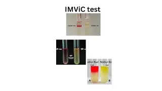 IMVIC test  # microbiology