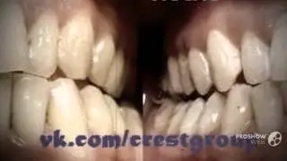 magic white отбеливание зубов   - Белые зубы каждой Леди!