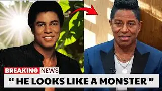 9 Black Male Celebrities Who Underwent The Worst Cosmetic Surgeries