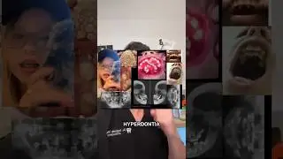 Hyperdontia 😢