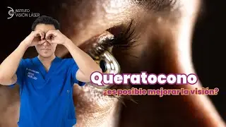 Keratoconus: Key Tools to Improve Your Vision