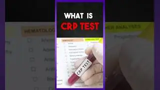 Что такое тест на СРБ (С-реактивный белок)?