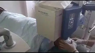 הסרת משקפיים בלייזר בשידור חי