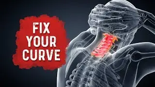 How To Fix Your Neck Posture/Curvature for Neck Pain Relief? &ndash; Dr. Berg