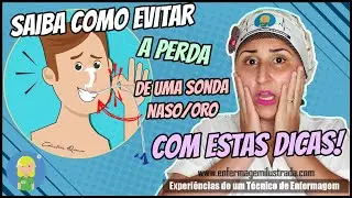 Com estas dicas, você pode EVITAR a PERDA de uma Sonda Enteral/Gástrica!