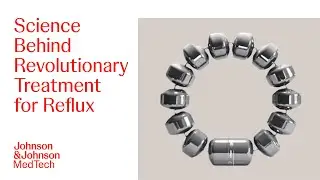 All about LINX Acid Reflux Management System Design | J&J MedTech