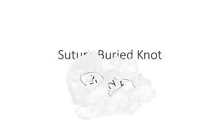 How to Tie a Buried Knot - PrePodiatryClinic101