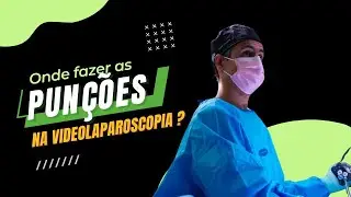 Onde fazer as pun&ccedil;&otilde;es na videolaparoscopia ?