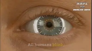 Child Blinking Hard A Lot
