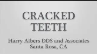 CrackedTeeth