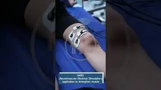 NMES (NEUROMUSCULAR ELECTIRICAL STIMULATION)