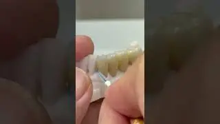 Eeep cleaning from ceramic bridges!