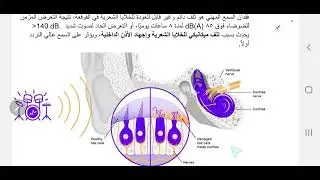 الأمراض المهنية الناتجة عن العوامل الفيزيائية (فقدان السمع المهني)