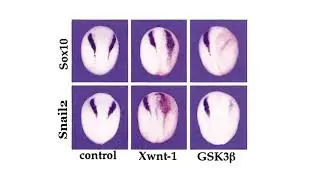 Les relations entre GSK3 et la voie Wnt mises en &eacute;vidence par gain-de-fonction chez le x&eacute;nope