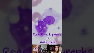 Reactive Lymphocytes versus Monocytes