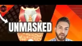 Can TRT unmask hypothyroidism