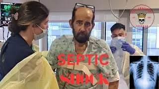 My Cancer Journey! I Was in SEPTIC SHOCK #olesnapper #cancer 