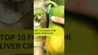 Top 10 Foods For Liver Cirrhosis #healthyfoods #livercirrhosis  #foods