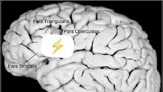Frontal Lobe Epilepsy: Frontal Operculum.