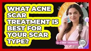 What Acne Scar Treatment Is Best For Your Scar Type? - Plastic Surgery Transformations
