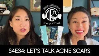 Acne Scars - What works and What to Expect | Chemist Confessions Podcast S4E34