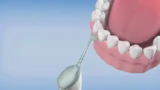 Como funciona Philips AirFloss