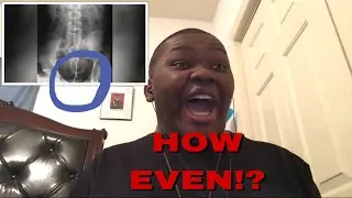 DeondreHawk7 REACTS To Top 10 Strangest X-Ray Images