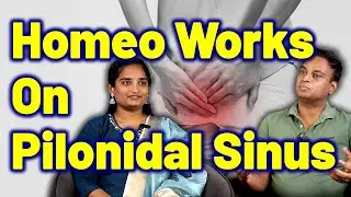 How Homeo Works on Pilonidal Sinus ? | Pilonidal Tract Disease Homeopathy Treatment Cure Medicine