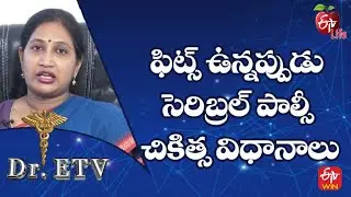 Cerebral Palsy and Epilepsy -  Treatment | Dr.ETV | 6th October 2022 | ETV Life