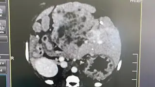 Короткий рассказ - множественные образования в печени у собаки