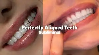 PERFECT TEETH ALIGNMENT Subliminal ✨ Straight, Symmetrical, Flawless Smile (Fast Results)