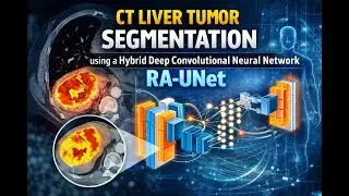 CT Liver Tumour Segmentation using a Hybrid Deep Convolutional Neural Network RA UNet